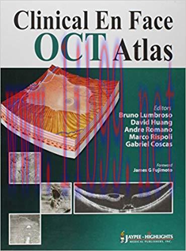 [PDF]Clinical En Face OCT Atlas