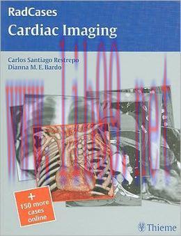 [AME]Cardiac Imaging (RadCases) (ORIGINAL PDF from_ Publisher)