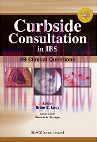 [PDF]Curbside Consultation in IBS