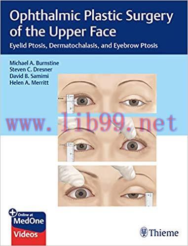 [PDF]Ophthalmic Plastic Surgery of the Upper Face PDF+VIDEOS