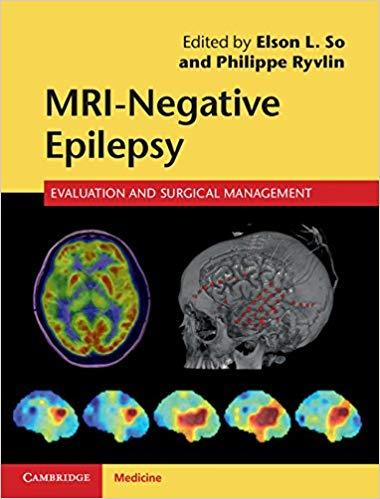 MRI-Negative Epilepsy Evaluation and Surgical Management