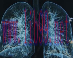 [AME]Pulmonary Medicine Board Review Course 2015 (CME Videos)