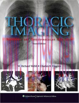 [AME]Thoracic Imaging: Pulmonary and Cardiovascular Radiology, 2nd Edition (ORIGINAL PDF from_ ...