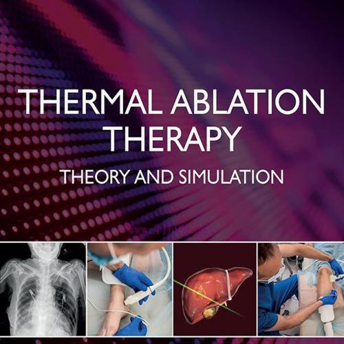 [AME]Thermal Ablation Therapy: Theory and Simulation (EPUB)