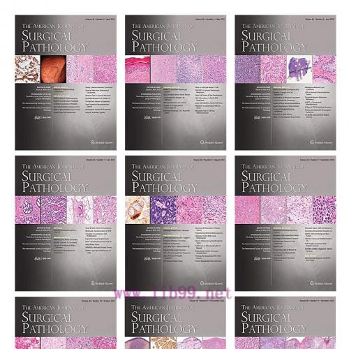 [AME]American Journal of Surgical Pathology 2022 Full Archives (True PDF)