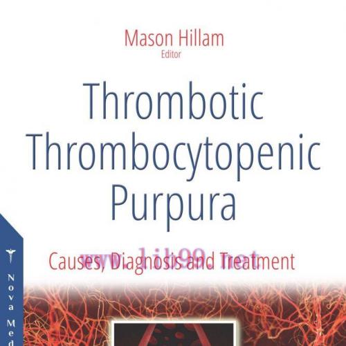 [AME]Thrombotic Thrombocytopenic Purpura: Causes, Diagnosis and Treatment (PDF)