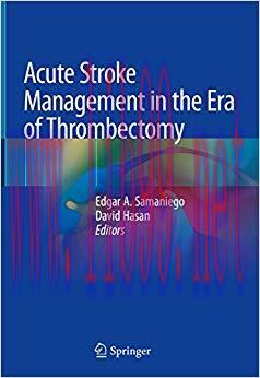 (PDF)Acute Stroke Management in the Era of Thrombectomy 1st ed. 2019 Edition