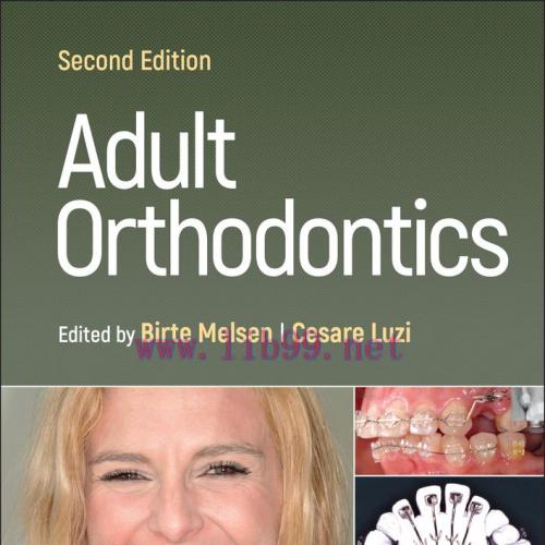 [AME]Adult Orthodontics, 2nd Edition (EPUB)
