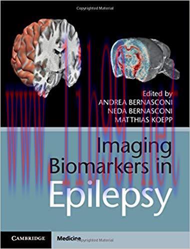 [PDF]Imaging Biomarkers in Epilepsy