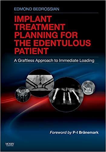 Implant Treatment Planning for the Edentulous Patient