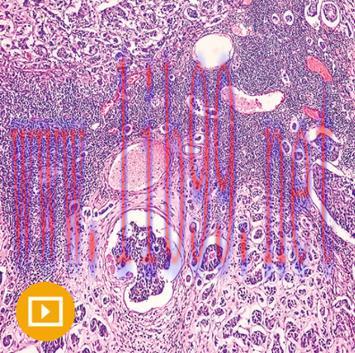 [AME]Breast Pathology 2023 (Videos)