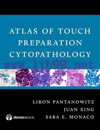 [AME]Atlas of Touch Preparation Cytopathology (EPUB)