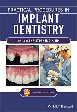 [AME]Practical Procedures in Implant Dentistry (EPUB)