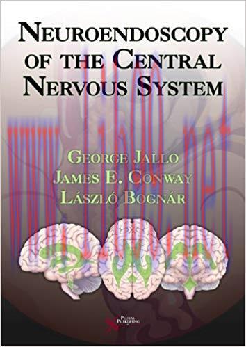 [PDF]Neuroendoscopy of the Central Nervous System