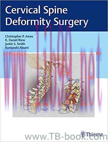 Cervical Spine Deformity Surgery 1st Edition by Christopher P. Ames