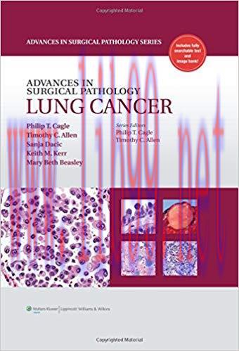 [PDF]Advances in Surgical Pathology - Lung Cancer+CHM版