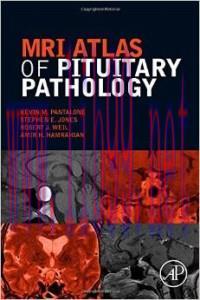 [AME]MRI Atlas of Pituitary Pathology (Original PDF)
