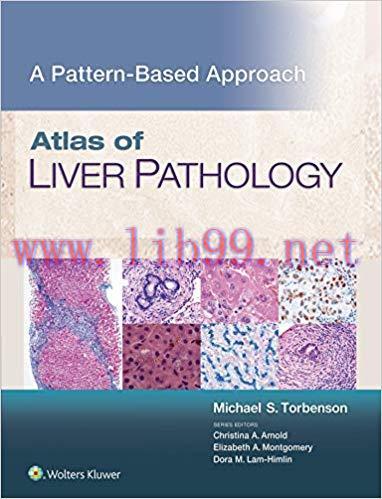 [EPUB]Atlas of Liver Pathology: A Pattern-Based Approach