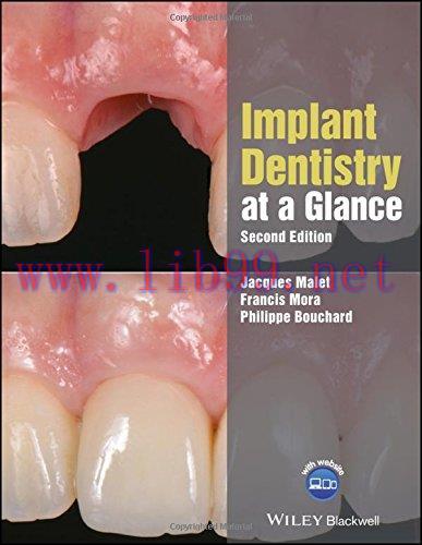 [AME]Implant Dentistry at a Glance (At a Glance (Dentistry)) (Original PDF)