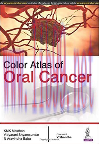 [PDF]Color Atlas of Oral Cancer