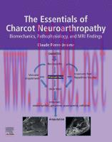 [PDF]The Essentials of Charcot Neuroarthropathy