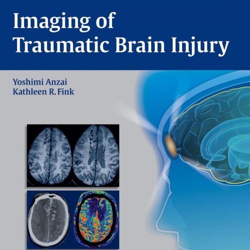 Imaging of Traumatic Brain Injury
