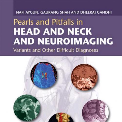 Pearls and Pitfalls in Head and Neck and Neuroimaging