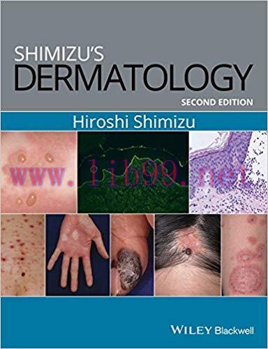 [PDF]Shimizu&rsquo;s Dermatology, 2nd Edition