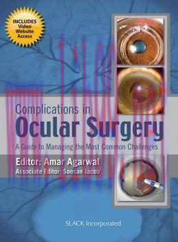 [AME]Complications in Ocular Surgery: A Guide to Managing the Most Common Challenges (ORIGINAL ...