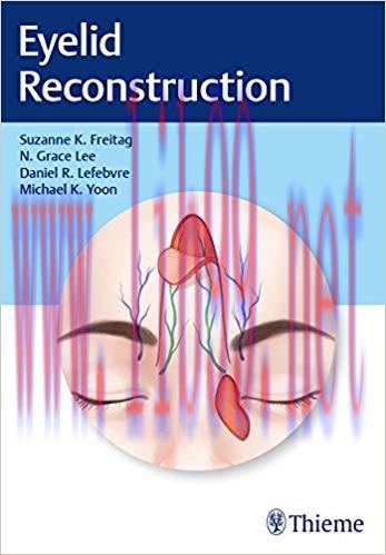 [PDF]Eyelid Reconstruction