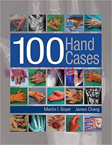 [PDF]100 Hand Cases