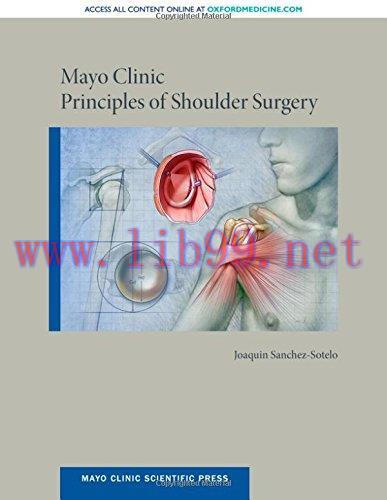 [AME]Mayo Clinic Principles of Shoulder Surgery (Mayo Clinic Scientific Press) (Original PDF)