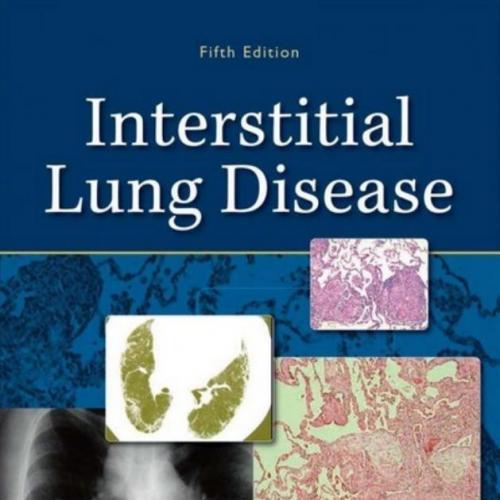 Interstitial Lung Disease, 5th Edition
