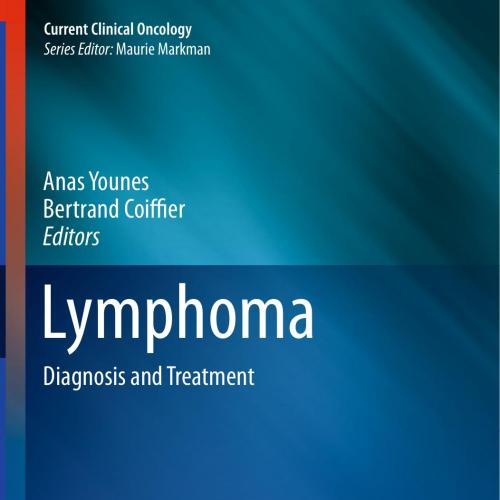 Lymphoma-Diagnosis and Treatment