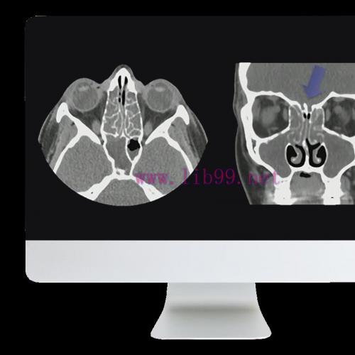 [AME]ARRS Cranial Nerve Imaging: From_ the Least to the Last 2022 ( Videos + CME Questions)
