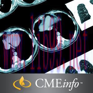 [AME]Thoracic Imaging 2016 (CME Videos)