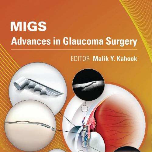 MIGS Advances in Glaucoma Surgery - Wei Zhi
