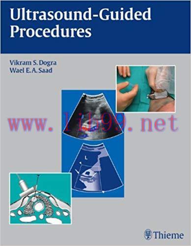 (PDF)Ultrasound-Guided Procedures 1st Edition