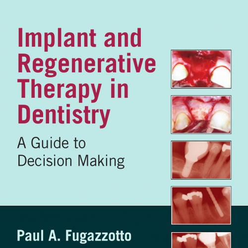 Implant and Regenerative Therapy in Dentistry A Guide to Decision Making