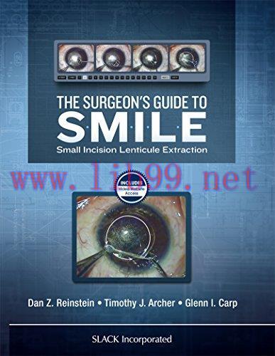 [AME]The Surgeon&rsquo;s Guide to SMILE: Small Incision Lenticule Extraction (PDF)