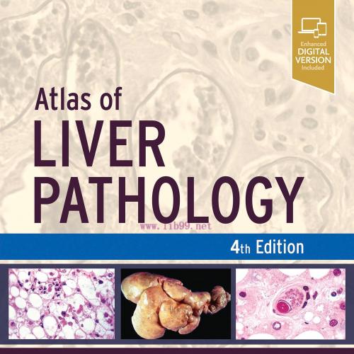 [AME]Atlas of Liver Pathology, 4th Edition (EPUB)