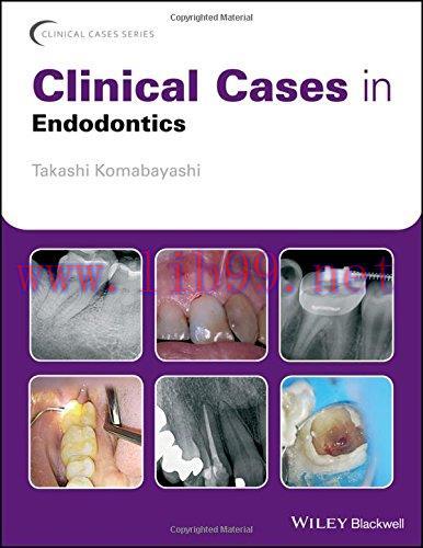 [AME]Clinical Cases in Endodontics (Clinical Cases (Dentistry)) (EPUB)