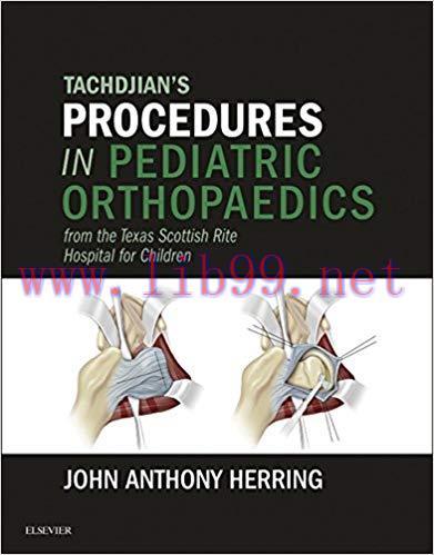 [PDF]Tachdjian’s Procedures in Pediatric Orthopaedics, 1e