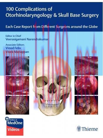 [AME]100 Complications of Otorhinolaryngology & Skull Base Surgery (Original PDF+Videos)
