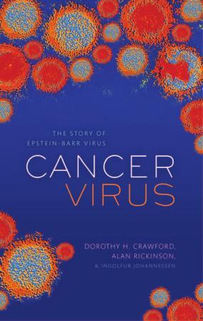 Cancer Virus The discovery of the Epstein-Barr Virus