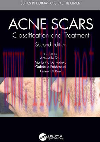 [AME]Acne Scars: Classification and Treatment, 2ed (PDF)