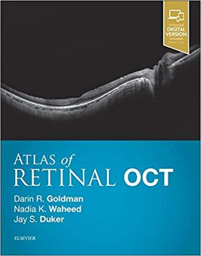 Atlas of Retinal OCT Optical Coherence Tomography, 1e HarPsc Edition