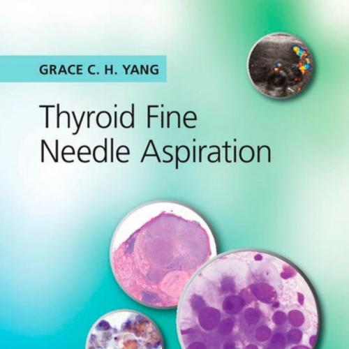 Thyroid Fine Needle Aspiration 1st Edition