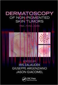 [AME]Dermatoscopy of Non-Pigmented Skin Tumors: Pink - Think - Blink