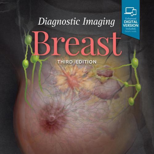 Diagnostic Imaging Breast 3rd by Wendie A. Berg